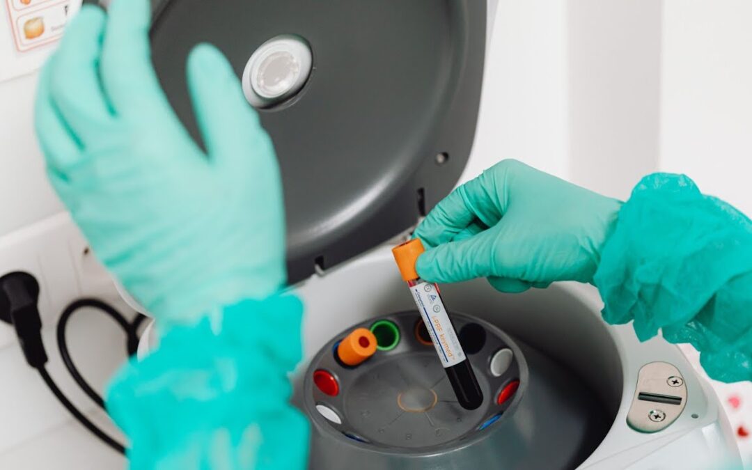 Should Hypnosis Be Used After Blood Tests Detect an Immune Disorder?